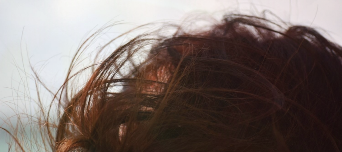 Philippine Summer Heat: Scalp Care Tips for Extreme Heat & Humidity